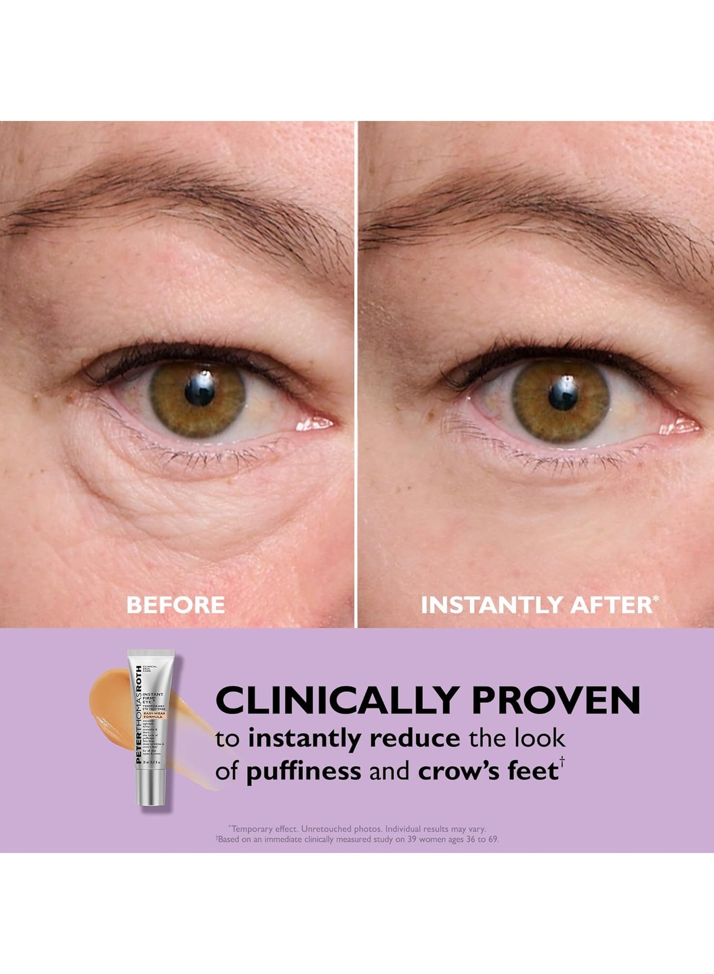 Peter Thomas Roth Face Tightener — image 2
